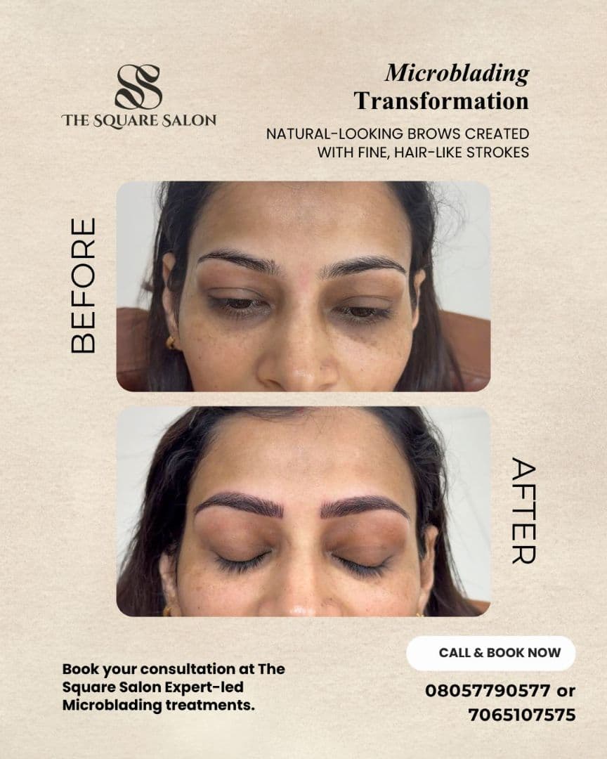 Before and after transformation at The Square Aesthetics & Wellness Clinic