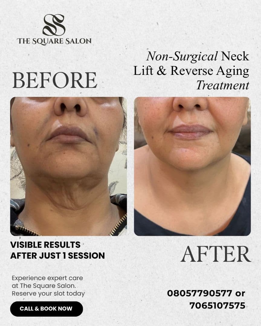 Before and after transformation at The Square Aesthetics & Wellness Clinic