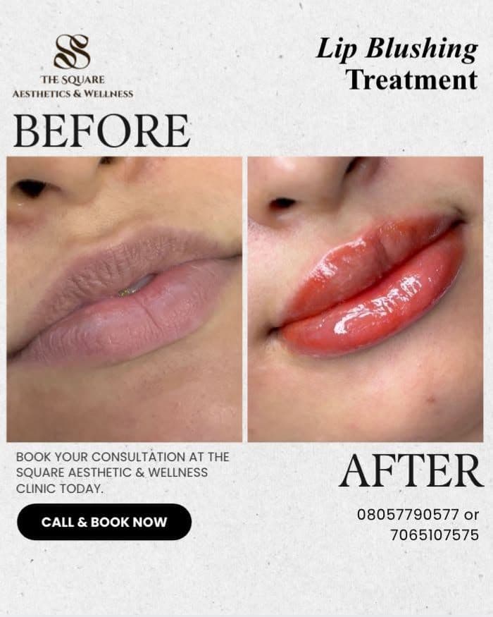 Before and after transformation at The Square Aesthetics & Wellness Clinic