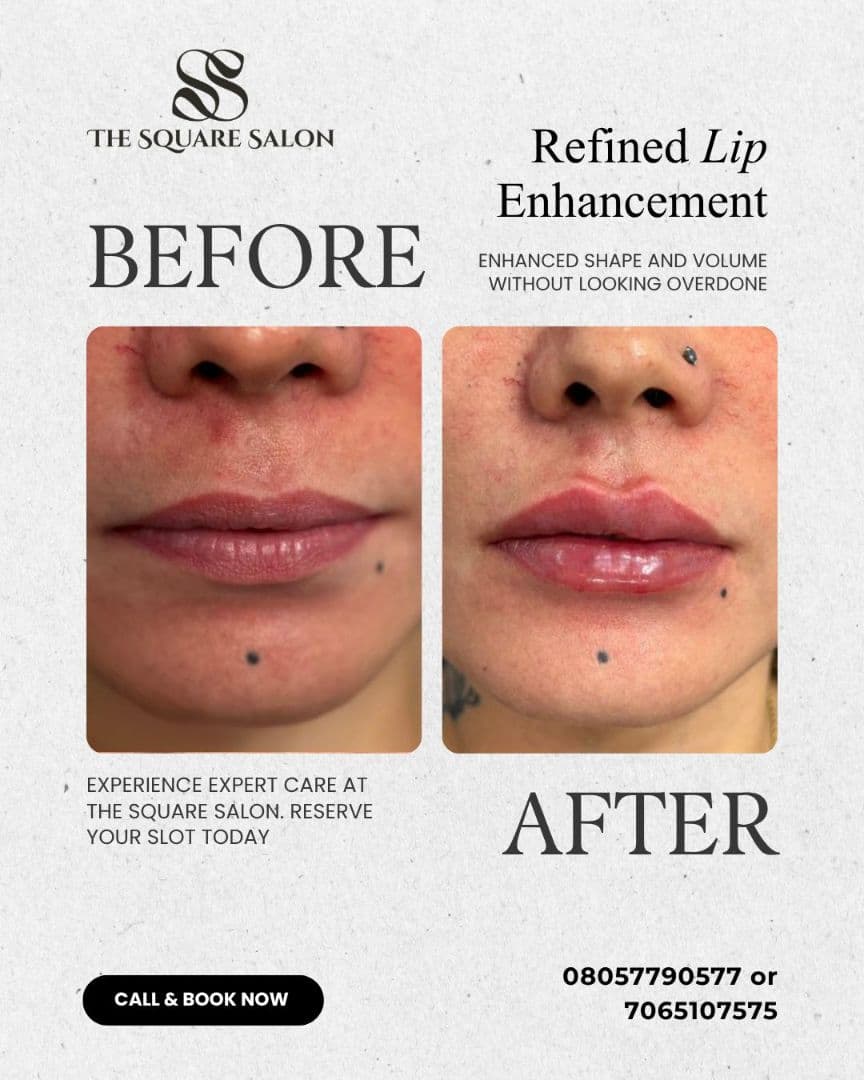 Before and after transformation at The Square Aesthetics & Wellness Clinic