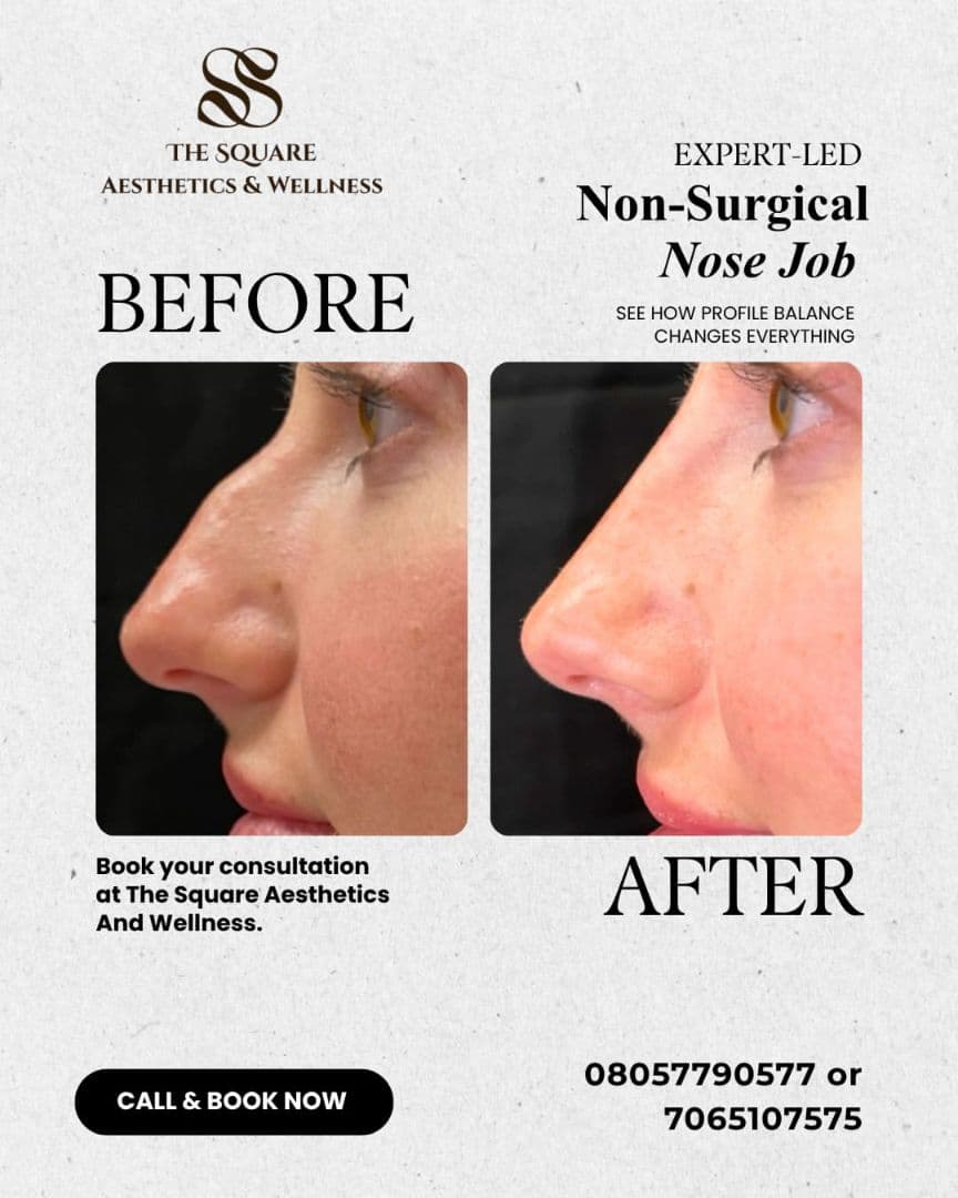 Before and after skin treatment results at Aesthetic Clinic, Rajouri Garden, Delhi