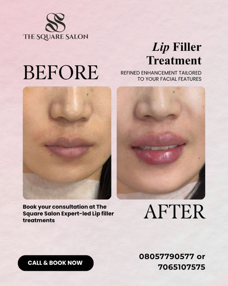 Before and after transformation at The Square Aesthetics & Wellness Clinic