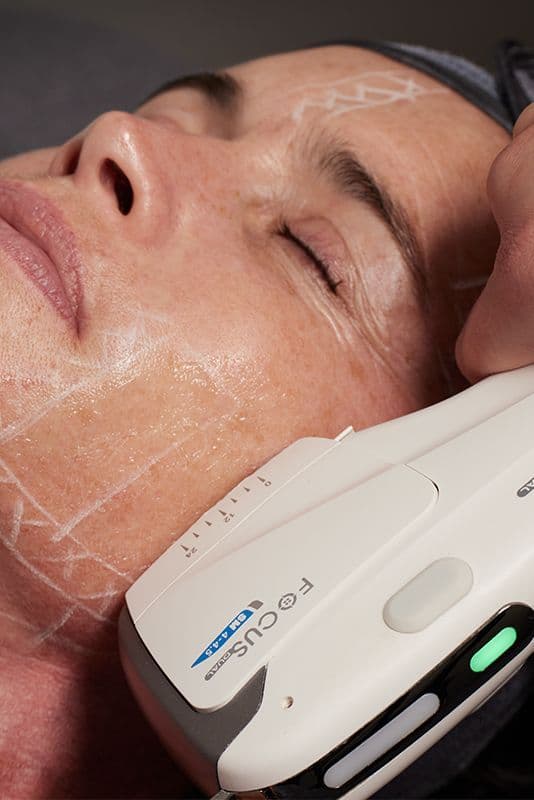 HIFU at The Square Aesthetics & Wellness Clinic, Rajouri Garden, Delhi
